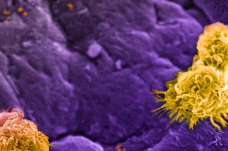 Tailoring nanoparticles to evade immune cells and prevent inflammatory response