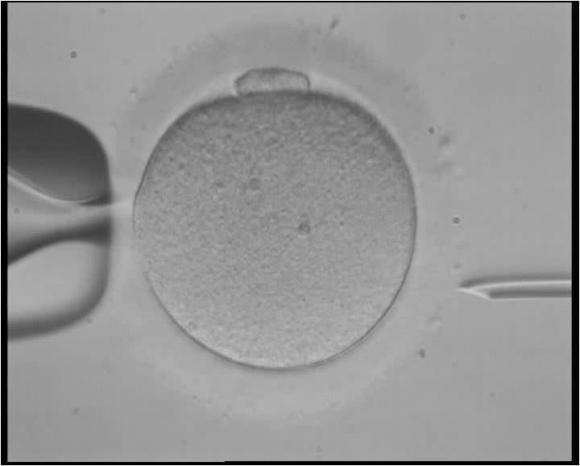 Technology to screen embryos before implantation falls short