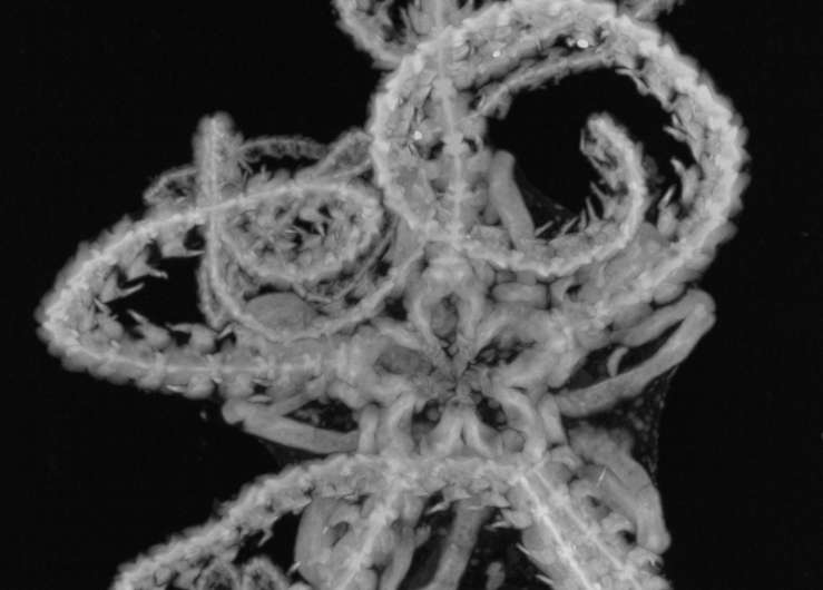 The first crowdfunded study in Japan: Micro X-ray observation of a fleshy brittle star
