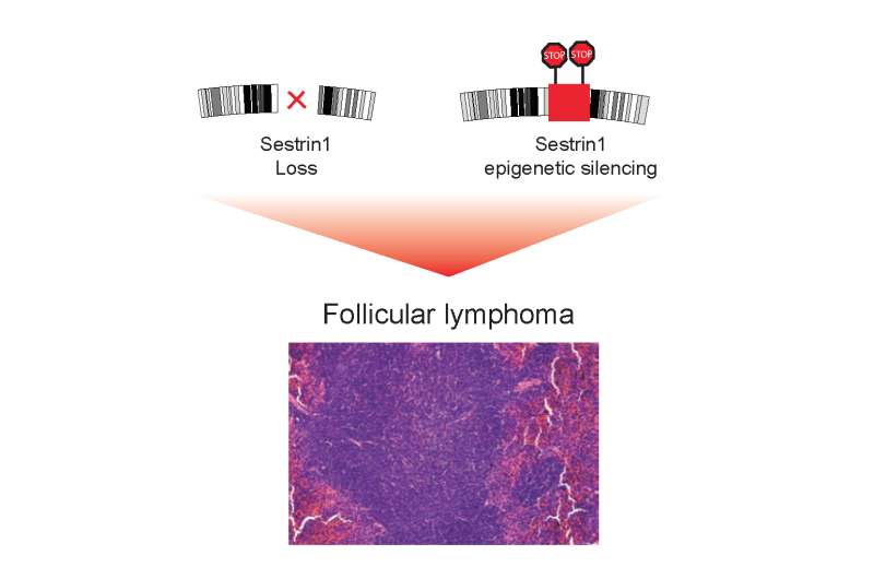 The gene behind follicular lymphoma