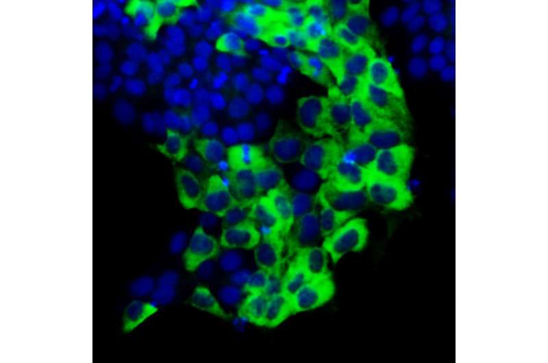 The protein TAZ sends 'mixed signals' to stem cells