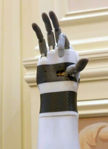 The &quot;prosthetic hand&quot; from BrainRobotics, controlled by signals sent from the residual muscles on an amputee's limb, i