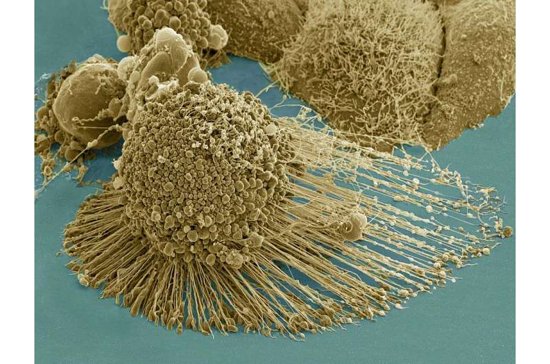 Thwarting metastasis by breaking cancer's legs with gold rods