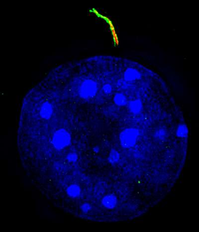 Tiny cellular antennae key to fat formation in muscle