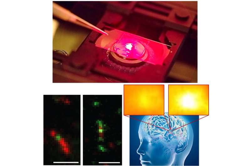 Tiny sensors developed to study the secrets of brain chemistry