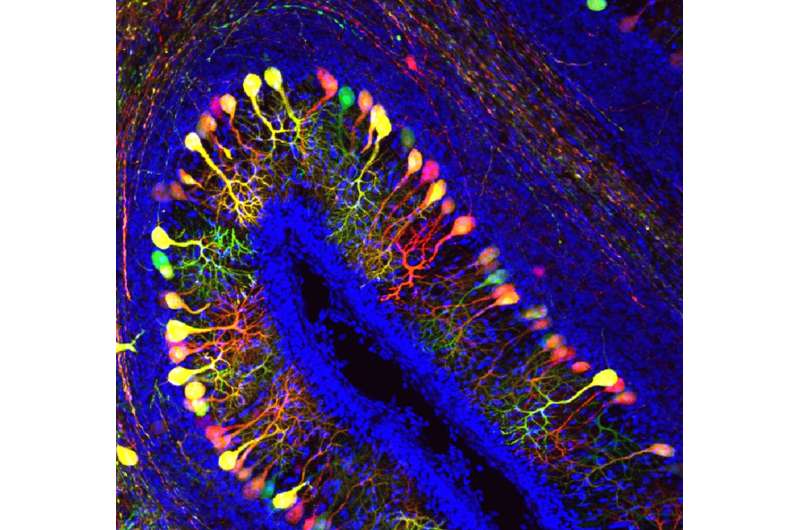 Transporter of thyroid hormones is crucial for the embryonal development of the brain