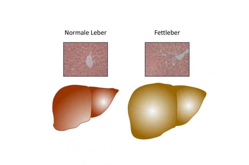 Trigger for fatty liver in obesity found