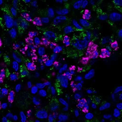 Tumor-seeking salmonella treats brain tumors
