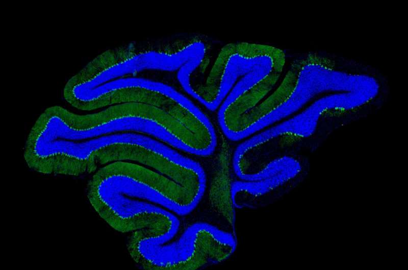 Turning off the protein tap -- A new clue to neurodegenerative disease