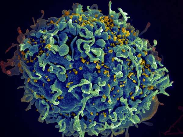 What does it take for an AIDs virus to infect a person?