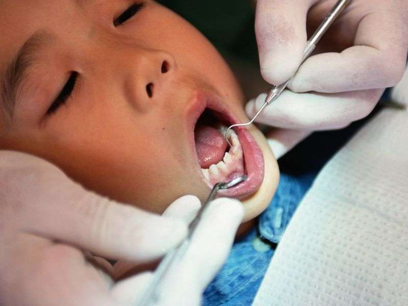 When families lack insurance, kids' dental woes rise