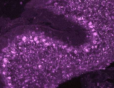 Zika uses axons to spread havoc in central nervous system
