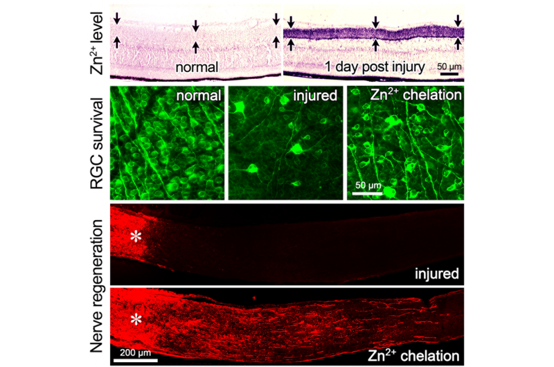 Zinc: A surprise target in regenerating the optic nerve after injury
