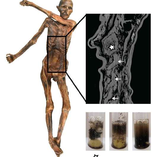 5,300-year-old Iceman's last meal reveals remarkably high-fat diet