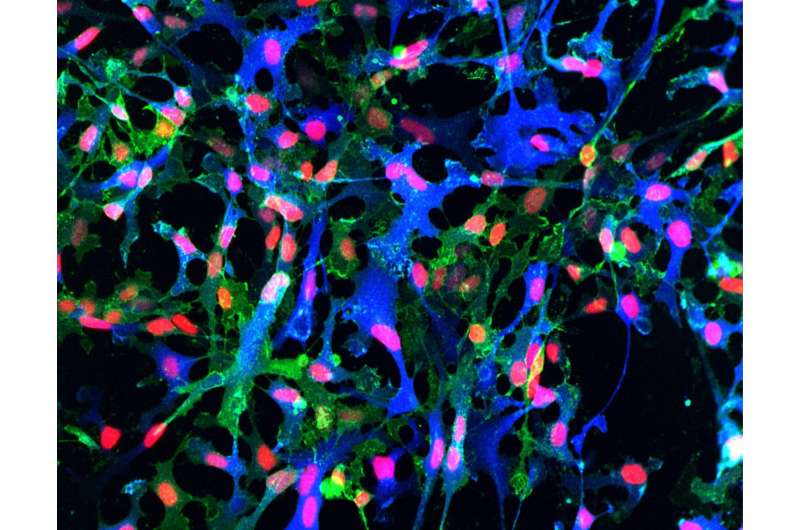 Model for producing brain’s “helper cells” could lead to treatments for alzheimer’s