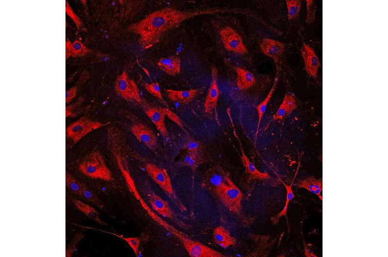 Blocking matrix-forming protein might prevent heart failure