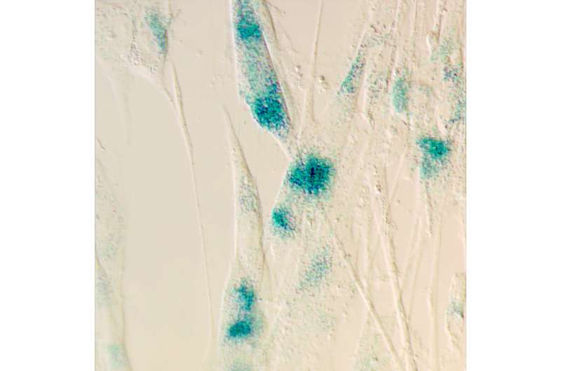 Cells stop dividing when this gene kicks into high gear, study finds