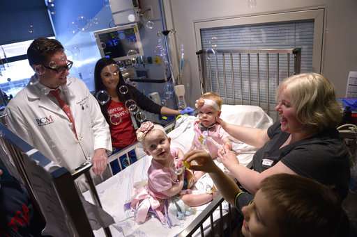 Conjoined twins separated at Houston hospital discharged