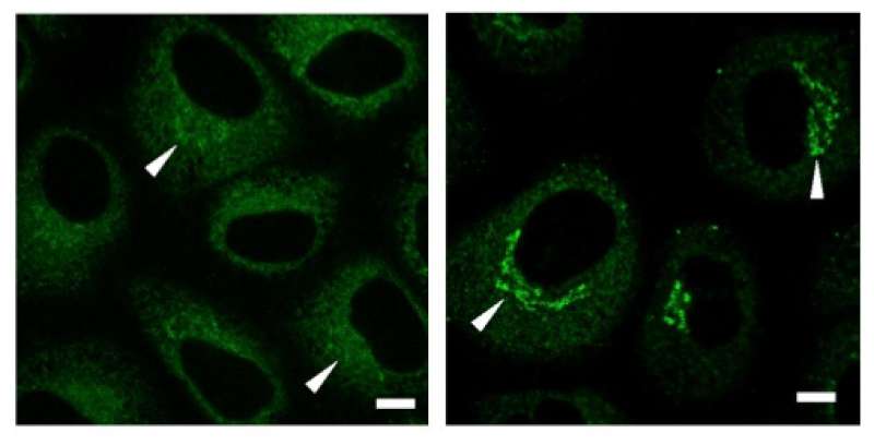 Enzyme found to control formation of collagen carriers and inhibit collagen secretion