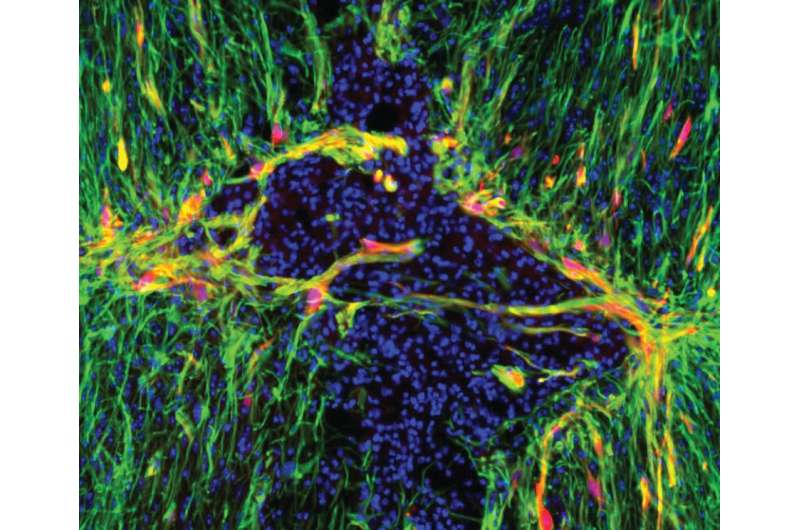 Gene therapy may help brain heal from stroke, other injuries