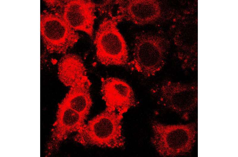 GLUT5 fluorescent probe fingerprints cancer cells