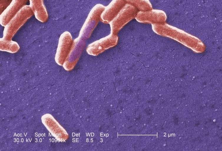 Gut microbes are tiny sensors of your general health