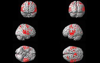 How does the brain learn categorization for sounds? The same way it does for images