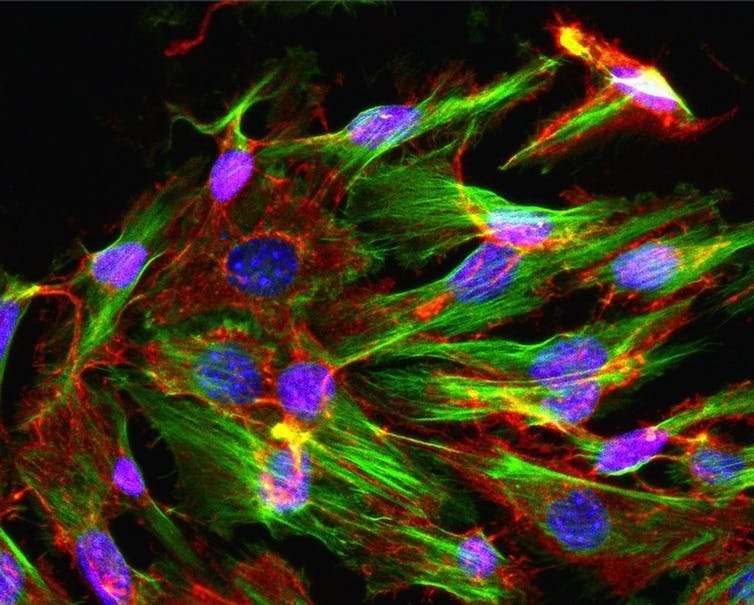 How rejuvenation of stem cells could lead to healthier aging