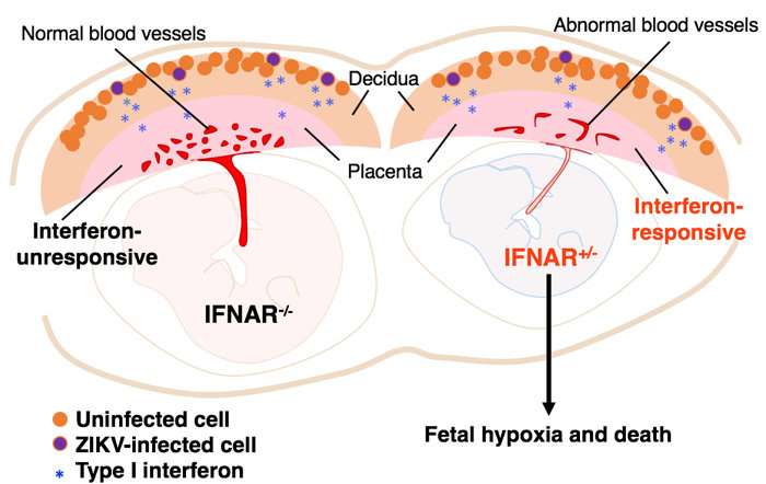 How Zika infection drives fetal demise