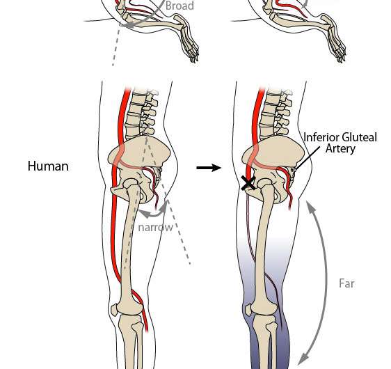 Humans risked limb ischemia in exchange for bipedal walking