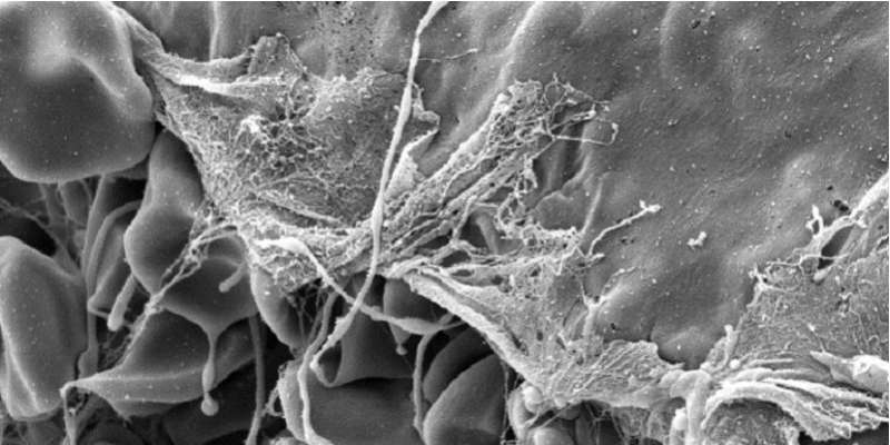 Nature creates its own plaster to protect wounds from infection