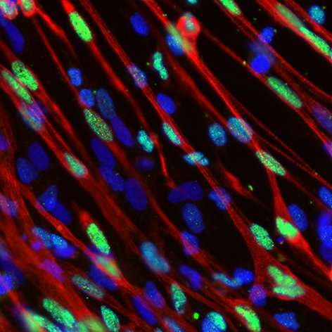 New lab technology could reveal treatments for muscle-wasting disease
