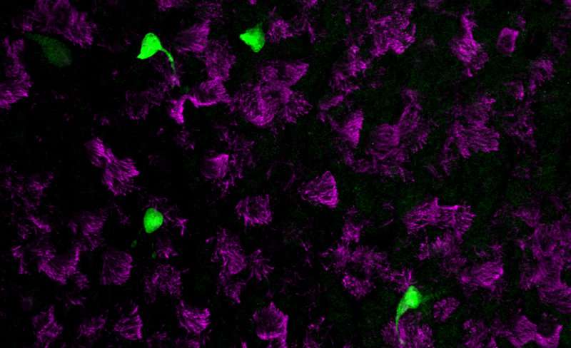 New lung cell type discovered
