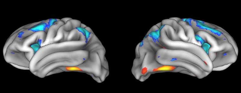 NIH releases first dataset from unprecedented study of adolescent brain development