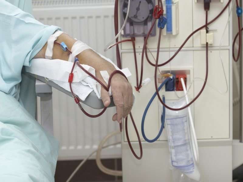 Patients with CKD face high symptom burden at end of life