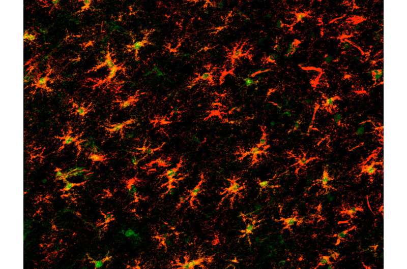 Scientists use gene expression to understand how astrocytes change with age