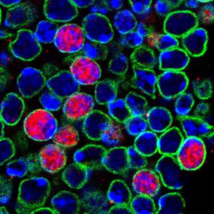'Sleeping' stem cells could aid brain repair