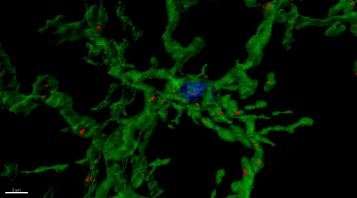 Study points to immune system's role in neural development