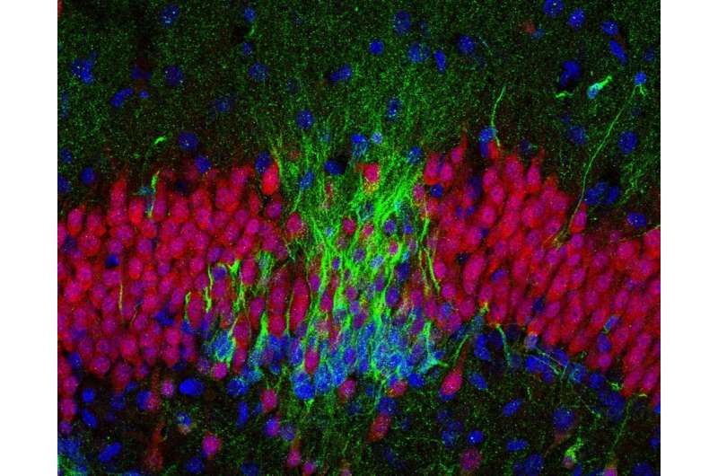 有争议的发现成人的大脑不生长新的神经元