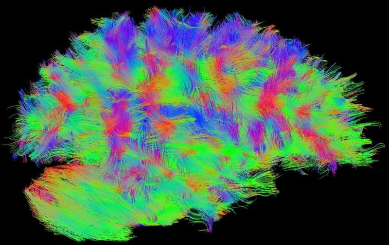 'Tic-tac-toe'-themed MRI technology easy win for neurological disease researchers
