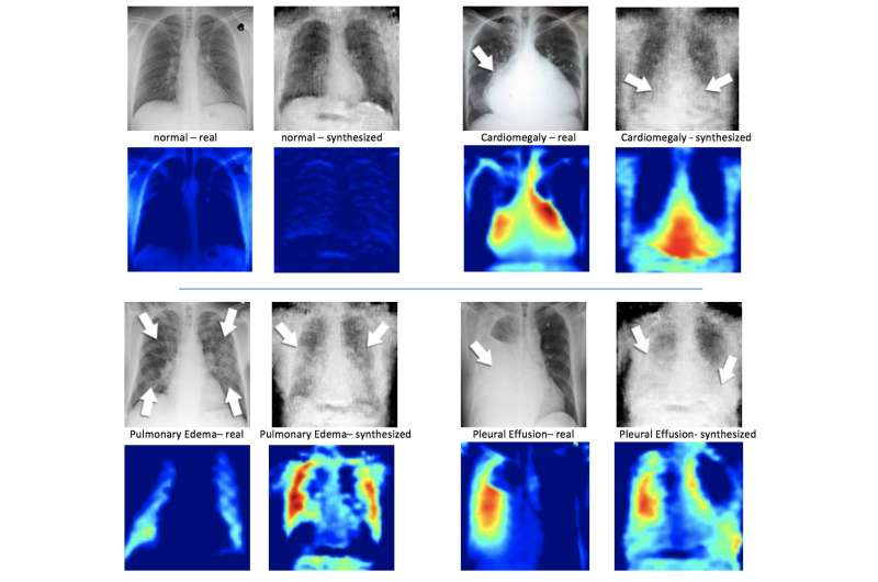 Training artificial intelligence with artificial X-rays