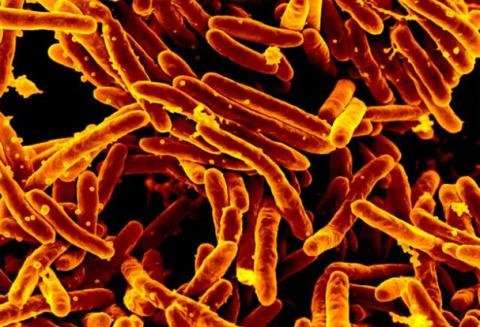 TB study reveals potential targets to treat and control infection thumbnail