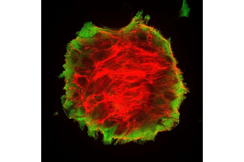Tumor cell expansion challenges current physics
