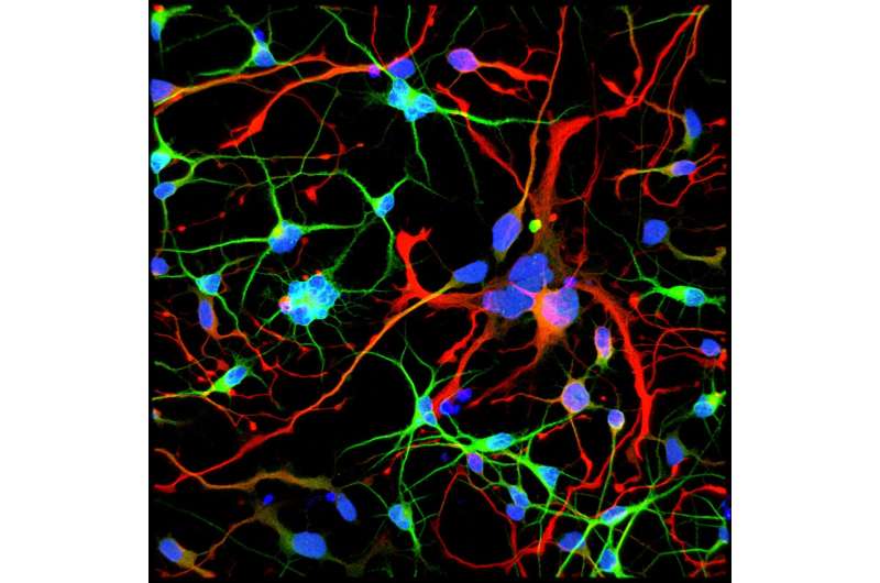 Uncovering the early origins of Huntington's disease