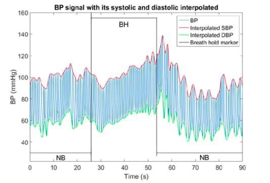 **Using photoplethysmography signal for mathematical modeling of arterial blood pressure
