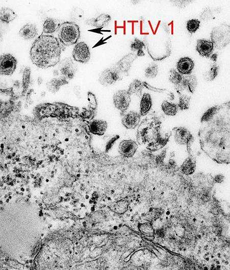 Prevalence of HTLV-1 infection among teens and adults in Gabon remains high
