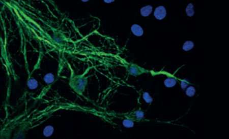 Scientists unravel molecular mechanisms of Parkinson’s disease