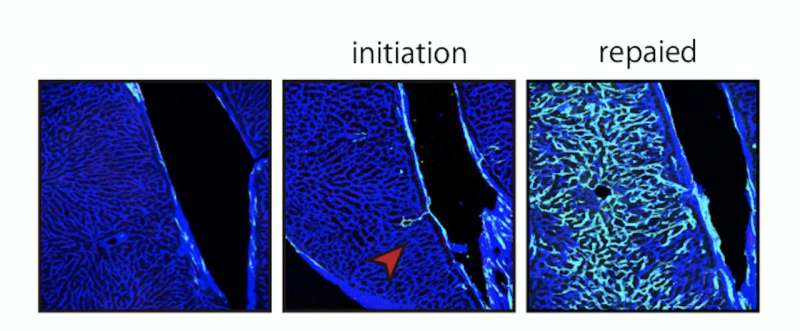 Researchers find adult endothelial stem cells that can make fully functional blood vessels