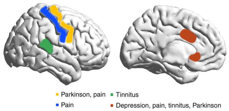 Study suggests brainwave link between disparate disorders