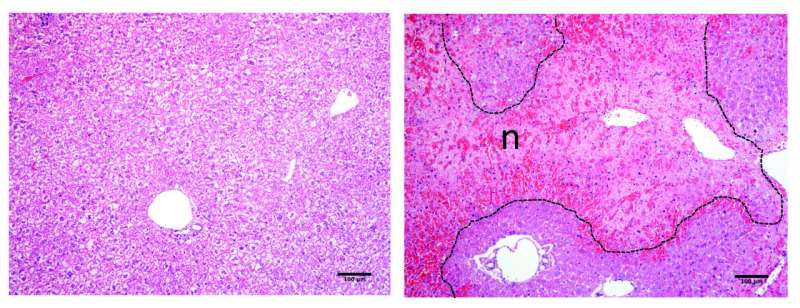 Researchers discover molecule involved in the repair of liver wounds